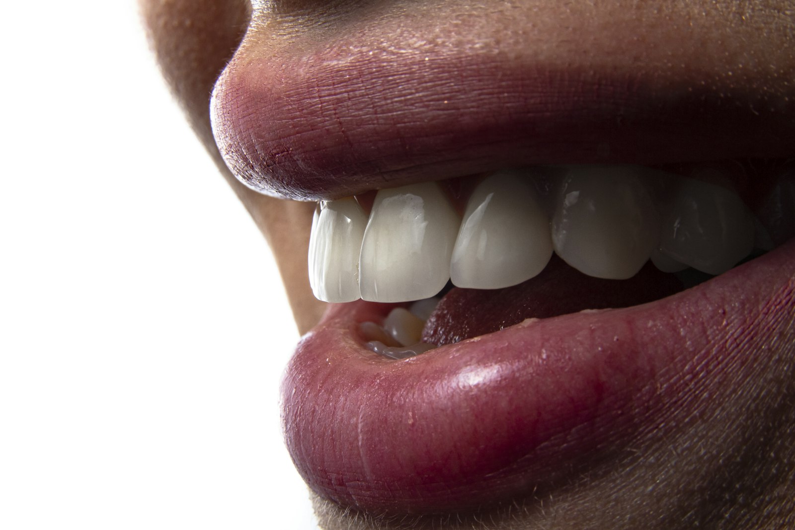 Close-up of a patient's restored smile